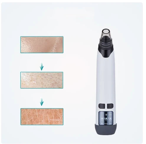 Pore Cleansing Vacuum Tool